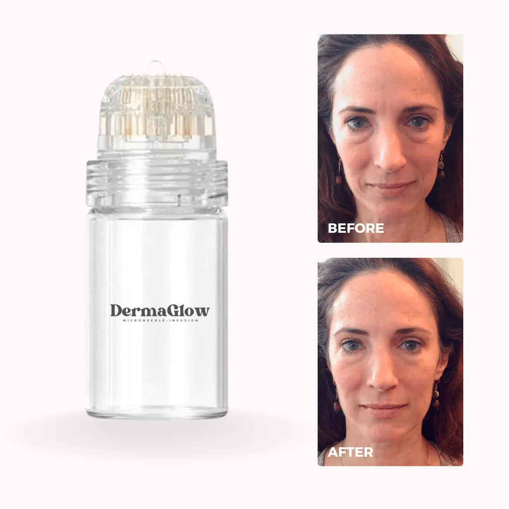 DermaGlow™ - Anti-Wrinkle Microneedle Serum System